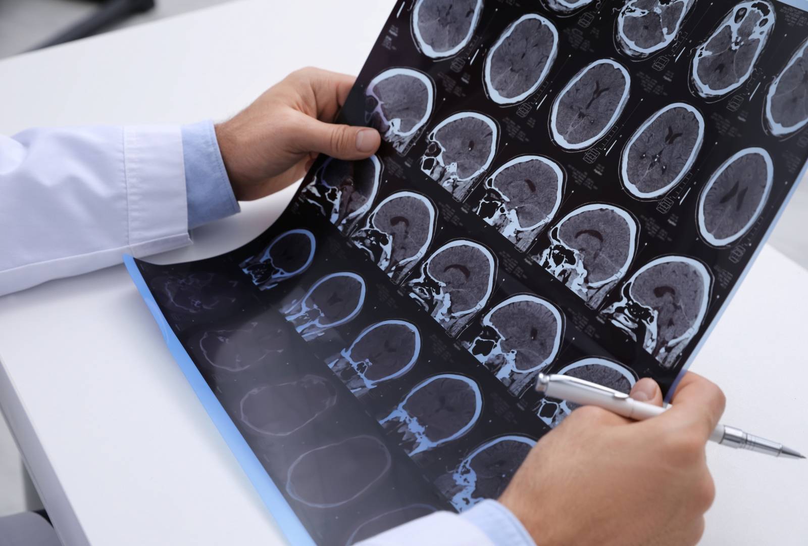 Checking for multiple sclerosis